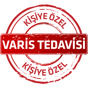 Kişiye Özel Varis Tedavisi